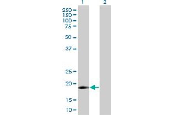 IFNA16 anticorps  (AA 1-189)