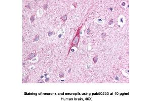 Image no. 1 for anti-ATPase Type 13A2 (ATP13A2) (AA 200-300), (Internal Region) antibody (ABIN363562) (ATP13A2 anticorps  (Internal Region))