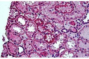 Human Kidney: Formalin-Fixed, Paraffin-Embedded (FFPE) (HYAL2 anticorps  (AA 2-12))