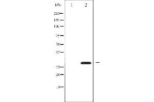 Western blot analysis of BCL-2 phosphorylation expression in nocodazole treated HeLa whole cell lysates,The lane on the left is treated with the antigen-specific peptide. (Bcl-2 anticorps  (pSer87))
