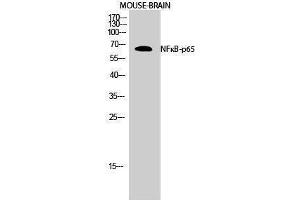 Western Blotting (WB) image for anti-Nuclear Factor-kB p65 (NFkBP65) (Thr70) antibody (ABIN3185885) (NF-kB p65 anticorps  (Thr70))