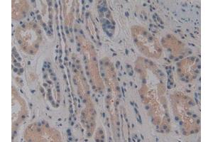 DAB staining on IHC-P; Samples: Human Kidney Tissue (NOSIP anticorps  (AA 62-295))