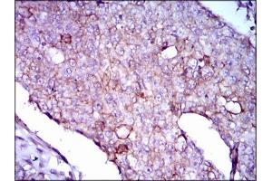 Immunohistochemistry (IHC) image for anti-Lipoprotein (Lp(a)) (AA 1823-2013) antibody (ABIN969533)