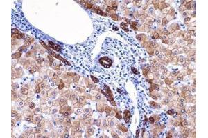 Immunohistochemistry (IHC) image for anti-Keratin 18 (KRT18) (C-Term) antibody (ABIN870573) (Cytokeratin 18 anticorps  (C-Term))