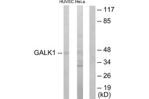 Western Blotting (WB) image for anti-Galactokinase 1 (GALK1) (N-Term) antibody (ABIN1849417) (GALK1 anticorps  (N-Term))