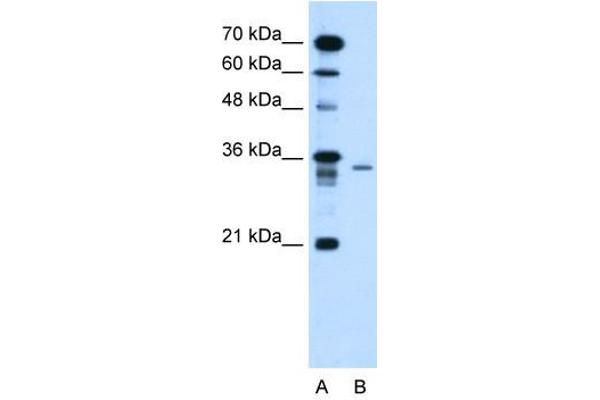 LY6G6F anticorps  (N-Term)