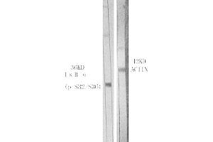 Western Blot analysis of various cells using Phospho-IκB-α (S32/S36) Polyclonal Antibody. (NFKBIA anticorps  (pSer32))