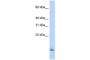 WB Suggested Anti-SCGB1A1 Antibody Titration:  0. (SCGB1A1 anticorps  (Middle Region))