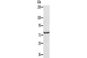 Western Blotting (WB) image for anti-Myxovirus Resistance Protein 1 (MX1) antibody (ABIN2430284) (MX1 anticorps)