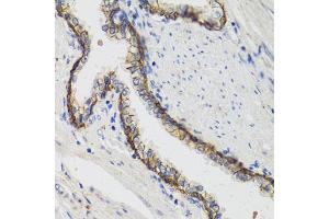 Immunohistochemistry of paraffin-embedded human prostate using ATP1A1 antibody (ABIN1871152) at dilution of 1:100 (40x lens). (ATP1A1 anticorps)