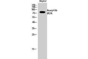 Western Blotting (WB) image for anti-Ubiquitin (Ubiquitin) (acLys29) antibody (ABIN3181497) (Ubiquitin anticorps  (acLys29))