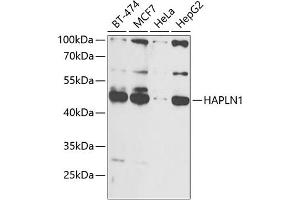 Western blot analysis of extracts of various cell lines, using H antibody (ABIN6129787, ABIN6141601, ABIN6141603 and ABIN6216048) at 1:1000 dilution. (HAPLN1 anticorps  (AA 165-354))