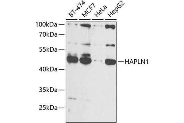 HAPLN1 anticorps  (AA 165-354)