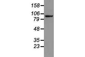 Western blot analysis of 35 µg of cell extracts from human colon adenocarcinoma (HT29) cells using anti-CTNNB1 antibody. (CTNNB1 anticorps  (AA 531-781))