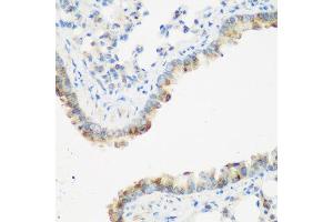 Immunohistochemistry of paraffin-embedded mouse lung using IGF2BP3 antibody at dilution of 1:200 (40x lens). (IGF2BP3 anticorps)