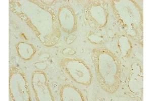 Immunohistochemistry of paraffin-embedded human kidney tissue using ABIN7159686 at dilution of 1:100 (CHCHD3 anticorps  (AA 1-227))