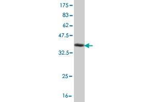 Western Blotting (WB) image for anti-Nuclear Receptor Subfamily 4, Group A, Member 2 (NR4A2) (AA 71-170) antibody (ABIN518477)