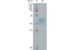 Human MRG Protein, hFc Tag on SDS-PAGE under reducing condition. (MRGPRX2 Protein (AA 1-33) (Fc Tag))
