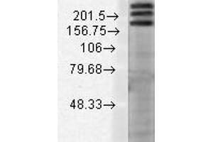 SHANK1 Western Blot. (SHANK1 anticorps  (Internal Region))