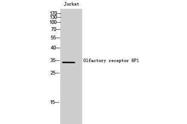 OR6P1 anticorps  (Internal Region)