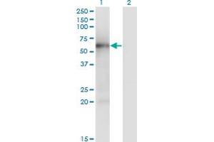 Western Blot analysis of MKNK1 expression in transfected 293T cell line by MKNK1 monoclonal antibody (M04), clone 5E12. (MKNK1 anticorps  (AA 1-465))