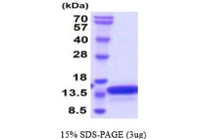 SDS-PAGE (SDS) image for Vesicle-Associated Membrane Protein 2 (Synaptobrevin 2) (VAMP2) (AA 1-94) protein (His tag) (ABIN7281224) (VAMP2 Protein (AA 1-94) (His tag))