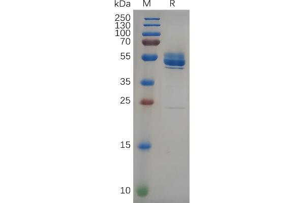 FZD10 Protein (AA 21-161) (Fc Tag)