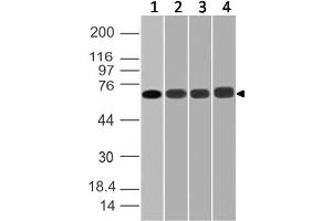 Image no. 1 for anti-DEAD (Asp-Glu-Ala-Asp) Box Polypeptide 3, X-Linked (DDX3X) (AA 10-230) antibody (ABIN5027139) (DDX3X anticorps  (AA 10-230))
