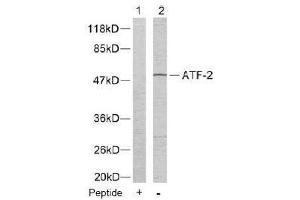 Image no. 2 for anti-Activating Transcription Factor 2 (ATF2) (Thr55), (Thr73) antibody (ABIN197151) (ATF2 anticorps  (Thr55, Thr73))