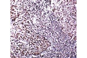 IHC-P: MYBL2 antibody testing of human tonsil tissue (MYBL2 anticorps  (N-Term))