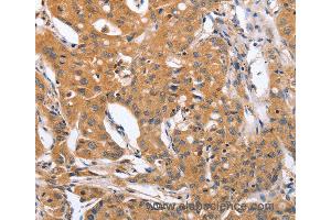 Immunohistochemistry of Human brain  using BLNK Polyclonal Antibody at dilution of 1:50 (B-Cell Linker anticorps)