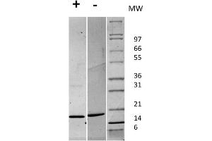 SDS-PAGE of Human Fibroblast Growth Factor 147 basic Recombinant Protein SDS-PAGE of Human Fibroblast Growth Factor 147 basic Recombinant Protein. (FGF2 Protéine)