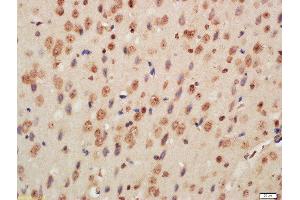 Formalin-fixed and paraffin embedded mouse brain labeled with Rabbit Anti-Histone H3 (Di Methyl K9) Polyclonal Antibody, Unconjugated  at 1:200 followed by conjugation to the secondary antibody and DAB staining (Histone 3 anticorps  (H3K9me))