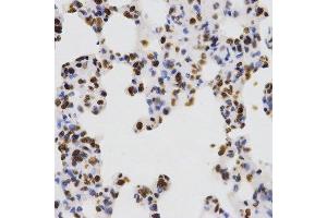 Immunohistochemistry (Paraffin-embedded Sections) (IHC (p)) image for anti-Histone 3 (H3) (H3K4me) antibody (ABIN3023251)