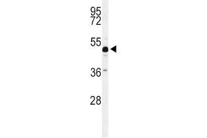 Western Blotting (WB) image for anti-Ankylosis, Progressive Homolog (Mouse) (ANKH) antibody (ABIN3004298) (ANKH anticorps)