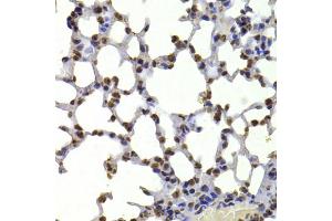 Immunohistochemistry of paraffin-embedded mouse lung using CBX5 antibody. (CBX5 anticorps)