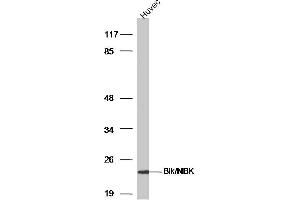 HUVEC lysates probed with Bik/NBK Polyclonal Antibody, Unconjugated  at 1:300 dilution and 4˚C overnight incubation. (BIK anticorps  (AA 10-90))