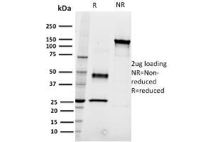 SDS-PAGE Analysis Purified CD22 Mouse Monoclonal Antibody (RFB4). (CD22 anticorps)