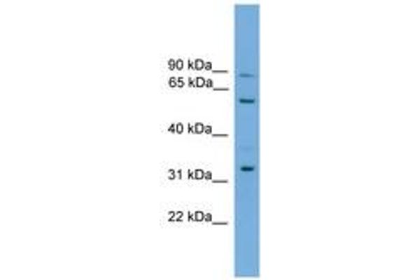 PTDSS2 anticorps  (AA 381-430)