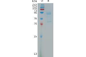 Microseminoprotein, Prostate Associated (MSMP) (AA 36-139) protein (Fc Tag)