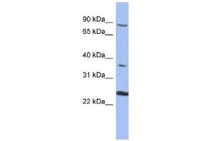 MPP3 antibody used at 1 ug/ml to detect target protein. (MPP3 anticorps)