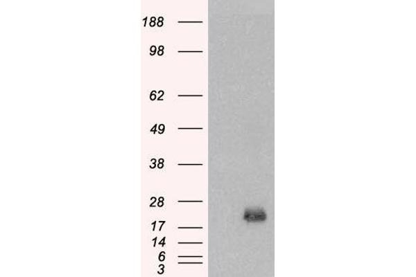 BAALC anticorps  (Internal Region)