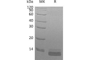 Greater than 95 % as determined by reducing SDS-PAGE. (CCL14 Protein (His tag))