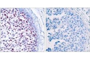 Immunohistochemistry (IHC) image for anti-Jun Proto-Oncogene (JUN) (pThr239) antibody (ABIN2888454) (C-JUN anticorps  (pThr239))