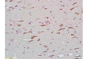 Formalin-fixed and paraffin embedded rat brain tissue labeled with Anti-phospho-Tau protein(Thr205) Polyclonal Antibody, Unconjugated (ABIN801813) at 1:200 followed by conjugation to the secondary antibody (tau anticorps  (pThr212))