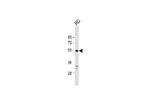 Anti-DUSP10 Antibody (N-term) at 1:1000 dilution + RD whole cell lysate Lysates/proteins at 20 μg per lane. (DUSP10 anticorps  (N-Term))
