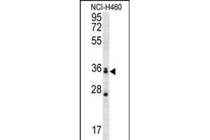 MBNL3 Antibody (Center) (ABIN657004 and ABIN2846185) western blot analysis in NCI- cell line lysates (35 μg/lane). (MBNL3 anticorps  (AA 251-280))