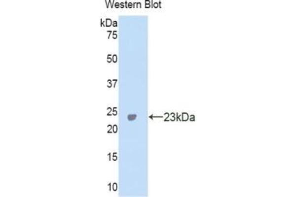 CA5A anticorps  (AA 7-179)