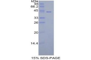 SDS-PAGE (SDS) image for Histone Cluster 1, H2aa (HIST1H2AA) (AA 2-131) protein (His tag,GST tag) (ABIN1878266) (HIST1H2AA Protein (AA 2-131) (His tag,GST tag))