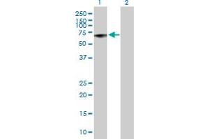 Western Blot analysis of MMP13 expression in transfected 293T cell line by MMP13 MaxPab polyclonal antibody. (MMP13 anticorps  (AA 1-471))